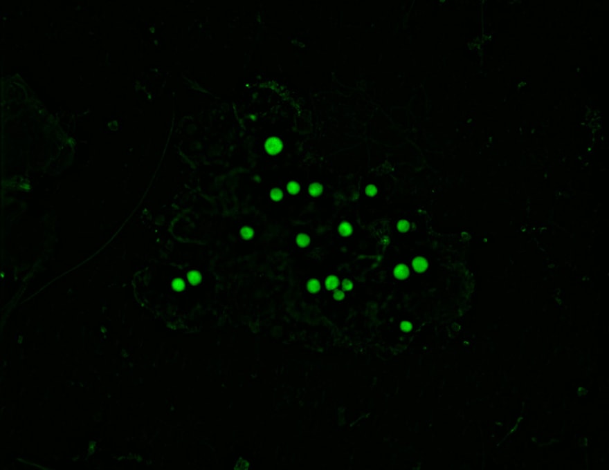 Illustration Crocosphaera - NOTION project - Climate & Biodiversity Initiative -